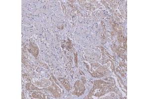 IHC analysis of WDR44 using anti-WDR44 antibody (ABIN7600394). (WDR44 抗体  (AA 188-913))