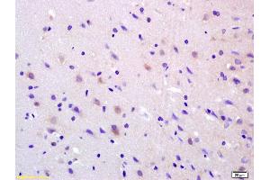 Formalin-fixed and paraffin embedded rat brain labeled with Anti-ADCY8 Polyclonal Antibody, Unconjugated (ABIN751228) at 1:200 followed by conjugation to the secondary antibody and DAB staining.