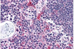 Human Thymus (formalin-fixed, paraffin-embedded) stained with CHEK1 antibody ABIN214737 at 5 ug/ml followed by biotinylated goat anti-rabbit IgG secondary antibody ABIN481713, alkaline phosphatase-streptavidin and chromogen. (CHEK1 抗体  (AA 192-241))