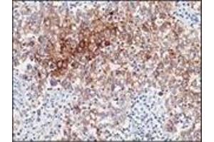 Immunohistochemistry (IHC) image for anti-Placental Alkaline Phosphatase (ALPP) antibody (ABIN870410) (PLAP 抗体)