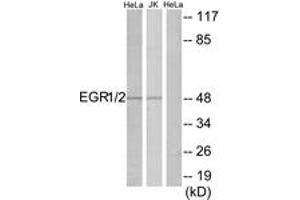 Western blot analysis of extracts from HeLa/Jurkat cells, using EGR1/2 Antibody. (EGR1 + EGR2 (AA 371-420) 抗体)
