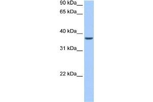 ALKBH8 antibody used at 0. (ALKBH8 抗体)