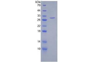 SDS-PAGE analysis of Human HSPG2 Protein. (HSPG2 蛋白)
