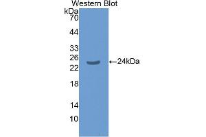 Western blot analysis of the recombinant protein. (SMAD1 抗体  (AA 273-468))