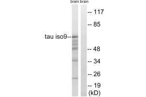 Western blot analysis of extracts from rat brain cells, using Tau (Ab-717/400) antibody. (MAPT 抗体  (Ser400, Ser717))