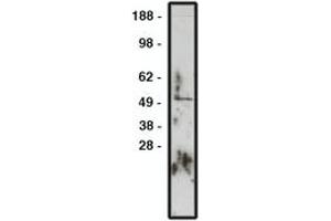 Image no. 1 for anti-Zinc Finger Protein GLI1 (GLI1) antibody (ABIN793725) (GLI1 抗体)