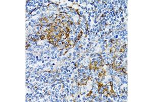 Immunohistochemistry of paraffin-embedded human tonsil using PGRMC1 antibody. (PGRMC1 抗体  (AA 44-195))