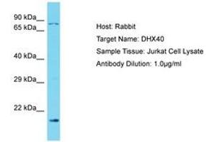 Image no. 1 for anti-DEAH (Asp-Glu-Ala-His) Box Polypeptide 40 (DHX40) (N-Term) antibody (ABIN6750559) (DEAH (Asp-Glu-Ala-His) Box Polypeptide 40 (DHX40) (N-Term) 抗体)