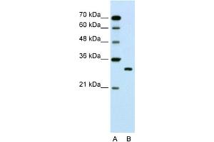 WB Suggested Anti-SBDS Antibody Titration:  1. (SBDS 抗体  (C-Term))