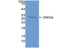 Detection of Recombinant FOXP3, Human using Polyclonal Antibody to Forkhead Box P3 (FOXP3) (FOXP3 抗体  (AA 191-412))