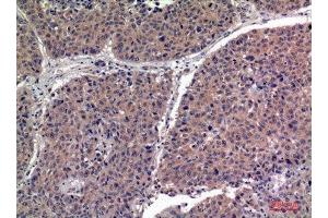 Immunohistochemistry (IHC) analysis of paraffin-embedded Human Lung, antibody was diluted at 1:100. (IGFBPI 抗体  (Internal Region))