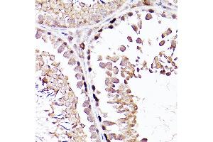 Immunohistochemistry (IHC) image for anti-Sal-Like 4 (SALL4) (AA 853-1053) antibody (ABIN7270138)