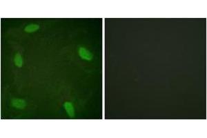 Immunofluorescence analysis of HeLa cells treated with Forskolin 40nM 30', using SSB (Phospho-Ser366) Antibody. (SSB 抗体  (pSer366))