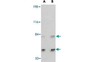Western blot analysis of SATB2 in A-20 cell lysate with SATB2 polyclonal antibody  at (A) 2 and (B) 4 ug/mL . (SATB2 抗体  (C-Term))