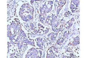 IHC analysis of ITCH/AIP4 using anti-ITCH/AIP4 antibody (ABIN7600263).