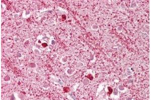Anti-DAP3 antibody IHC staining of human brain, cortex. (DAP3 抗体  (AA 387-398))