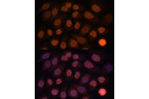 Immunofluorescence analysis of HeLa cells using KLF6 antibody (ABIN6131578, ABIN6142923, ABIN6142924 and ABIN6214111) at dilution of 1:100. (KLF6 抗体  (AA 40-200))
