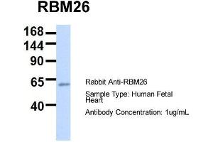 Host:  Rabbit  Target Name:  RBM26  Sample Type:  Human Fetal Heart  Antibody Dilution:  1. (RBM26 抗体  (Middle Region))