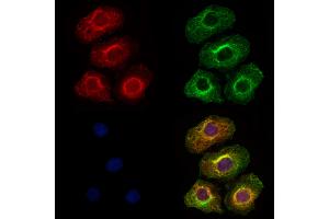 ABIN6264963 and ABIN6273315 staining Hela cells by IF/ICC.