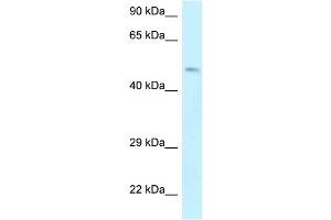 WB Suggested Anti-EPB49 Antibody Titration: 1. (Dematin 抗体  (Middle Region))