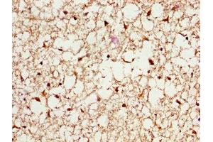 IHC image of ABIN7164919 diluted at 1:200 and staining in paraffin-embedded human brain tissue performed on a Leica BondTM system.