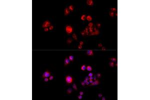 Immunofluorescence analysis of HeLa cells using GLUD2 antibody.