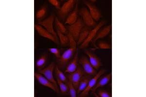 Immunofluorescence analysis of U2OS cells using JNK1/2/3 Rabbit pAb (ABIN7268630) at dilution of 1:100 (40x lens). (MAPK8/9/10 抗体)