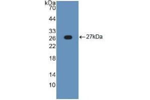 Western blot analysis of recombinant Human TNFRSF1A. (TNFRSF1A 抗体  (AA 248-428))