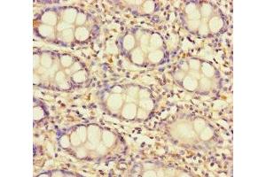 Immunohistochemistry of paraffin-embedded human colon tissue using ABIN7171536 at dilution of 1:100 (TAS2R13 抗体  (AA 150-184))