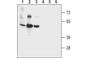 Western blot analysis of human colon cancer cell lines Colo-205 (lanes 1 and 4), human T-84 colonic adenocarcinoma cell line (lanes 2 and 5) and human colon cancer HT-29 cell line (lanes 3 and 6): - 1-3. (Bestrophin 2 抗体  (3rd Extracellular Loop))