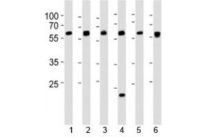Western blot analysis of lysate from 1) 293, 2) HepG2, 3) HUVEC, 4) Raji, 5) rat C6 and 6) mouse C2C12 cell line using SPHK1 antibody at 1:1000. (SPHK1 抗体  (AA 286-315))