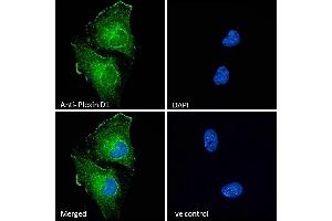 (ABIN185358) Immunofluorescence analysis of paraformaldehyde fixed U251 cells, permeabilized with 0. (PLXND1 抗体  (Internal Region))