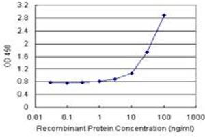 Sandwich ELISA detection sensitivity ranging from 1 ng/mL to 100 ng/mL. (ANXA5 (人) Matched Antibody Pair)