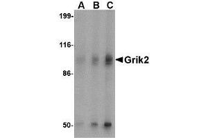 Western blot analysis of Grik2 in human brain tissue lysate with AP30382PU-N Grik2 antibody at (A) 0. (GRIK2 抗体  (C-Term))