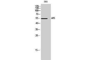 Western Blotting (WB) image for anti-Aristaless Related Homeobox (ARX) (Internal Region) antibody (ABIN3180497) (Arx 抗体  (Internal Region))