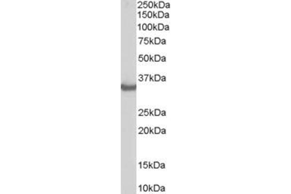STUB1 抗体  (C-Term)