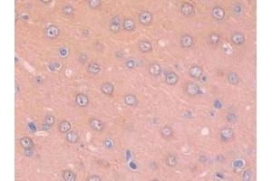 DAB staining on IHC-P;;Samples: Rat Cerebrum Tissue (Renin 抗体  (AA 144-237))