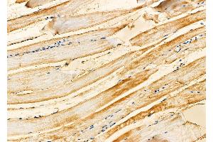 ABIN6261125 and ABIN6279831 at 1/100 staining Mouse muscle tissue by IHC-P.