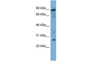 WB Suggested Anti-UBE2F Antibody Titration: 0. (UBE2F 抗体  (Middle Region))