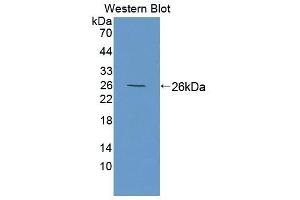 Detection of Recombinant MTX1, Human using Polyclonal Antibody to Metaxin 1 (MTX1) (Metaxin 1 抗体  (AA 175-387))