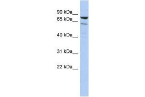 WB Suggested Anti-C1orf103 Antibody Titration: 0. (C1orf103 抗体  (Middle Region))