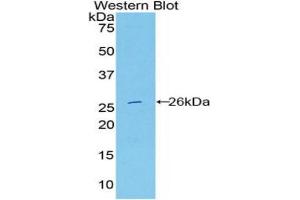 Western blot analysis of the recombinant protein. (DNASE1L2 抗体  (AA 32-229))