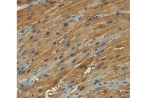 Used in DAB staining on fromalin fixed paraffin- embedded heart tissue (ANKRD1 抗体  (AA 6-291))