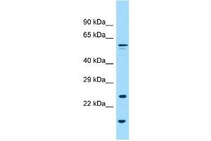 WB Suggested Anti-GPC6 Antibody Titration: 1. (Glypican 6 抗体  (N-Term))