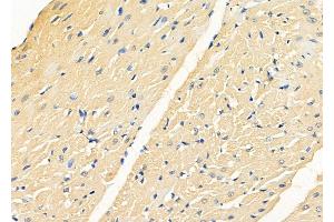 ABIN6262847 and ABIN6278586 at 1/100 staining Rat heart tissue by IHC-P.