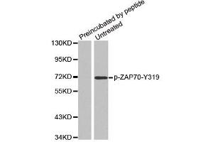 Western Blotting (WB) image for anti-zeta-Chain (TCR) Associated Protein Kinase 70kDa (ZAP70) (pTyr319) antibody (ABIN1870700) (ZAP70 抗体  (pTyr319))