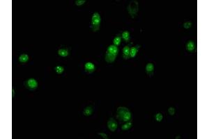 Immunofluorescence staining of MCF-7 cells with ABIN7162500 at 1:133, counter-stained with DAPI. (PAX5 抗体  (AA 362-391))