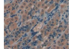 DAB staining on IHC-P; Samples: Rat Intestine Tissue (PROS1 抗体  (AA 416-646))