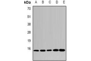 Western blot analysis of LSm4 expression in HepG2 (A), MCF7 (B), mouse kidney (C), mouse heart (D), rat liver (E) whole cell lysates. (LSM4 抗体)