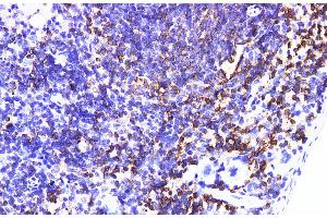 Immunohistochemistry of paraffin-embedded Mouse spleen using IL6R Polyclonal Antibody at dilution of 1:200 (IL-6 Receptor 抗体)